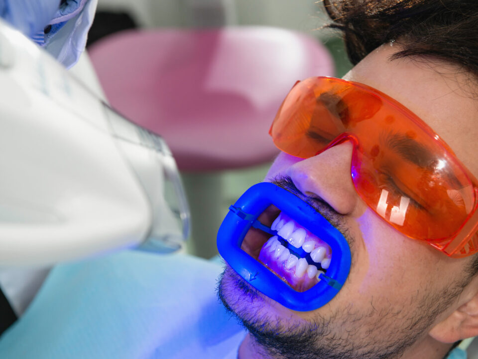 Zoom Teeth Whitening Newport Beach Ca