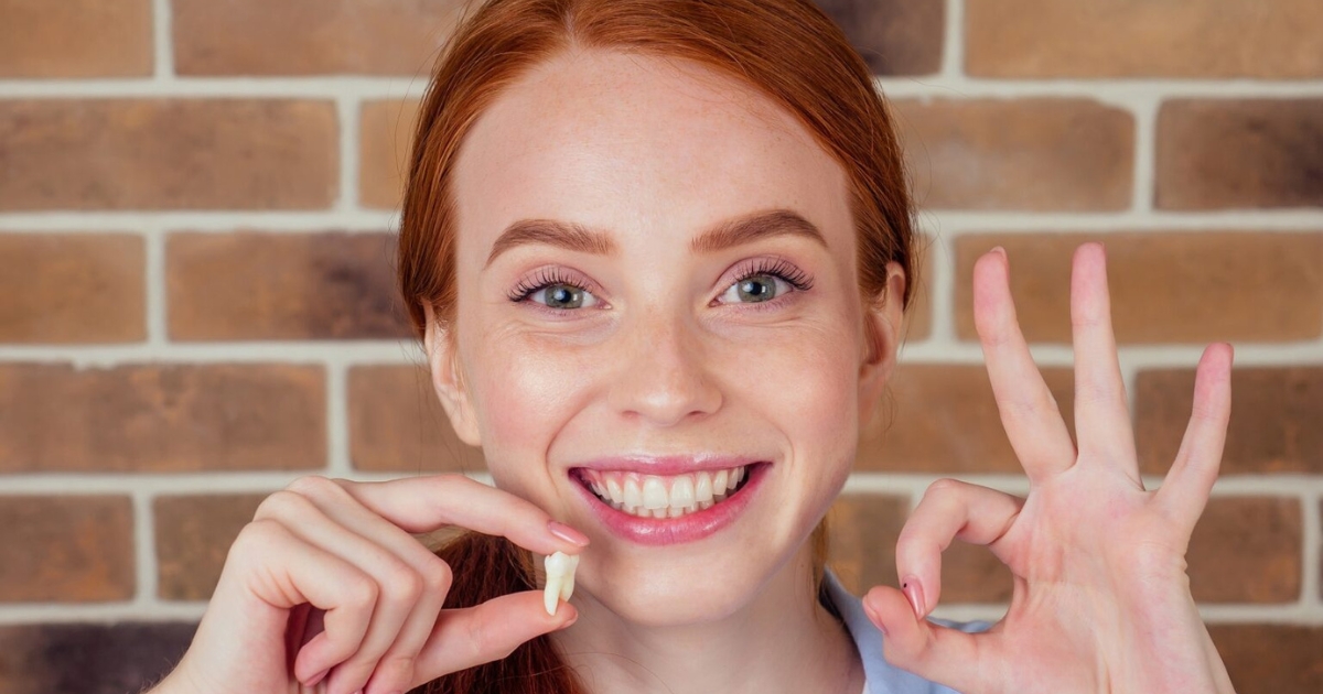 wisdom teeth extraction — featured image