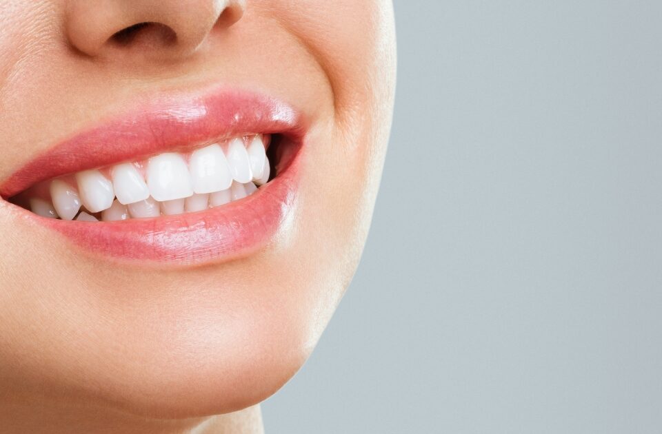 professional teeth whitening — featured image