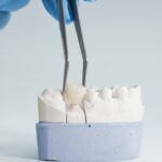 crowns for teeth — featured image